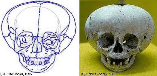 Alien skull?